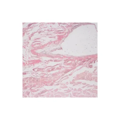 KIT GRAM 100 TEST