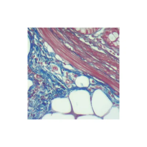 KIT MASSON TRICHROME 100 TEST