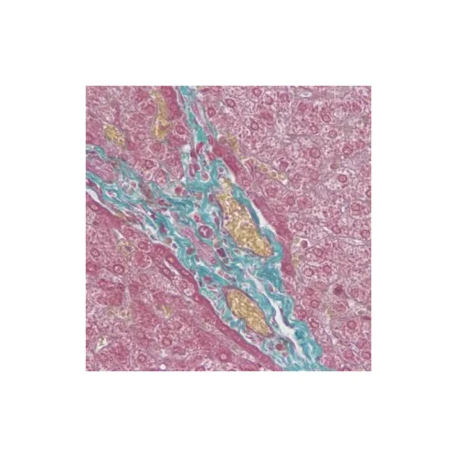 KIT MASSON TRICHROME GOLDNER 100 TEST